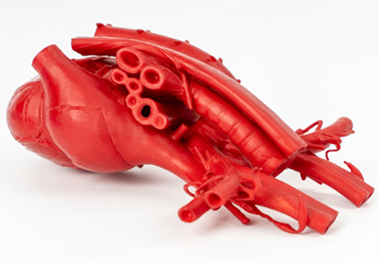 医疗器械手板-3d打印医疗器官模型心脏案例