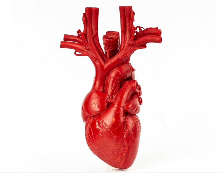 医疗器械手板-3d打印医疗器官模型心脏案例2